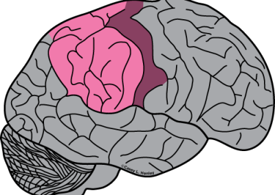 Human brain with the parietal lobe colored pink and the somatosensory cortex colored dark pink.